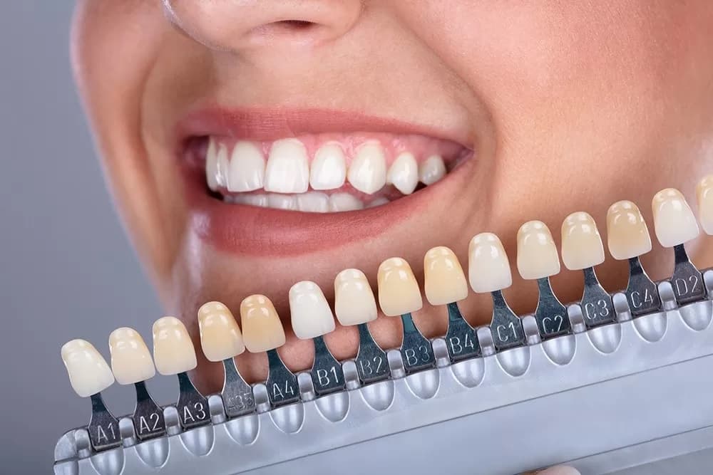 Cosmetic Dentistry